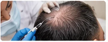 Medical trichology hair and scalp training